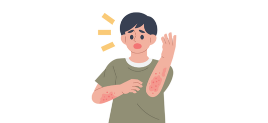Allergien - Wissenschaftliche Informationen